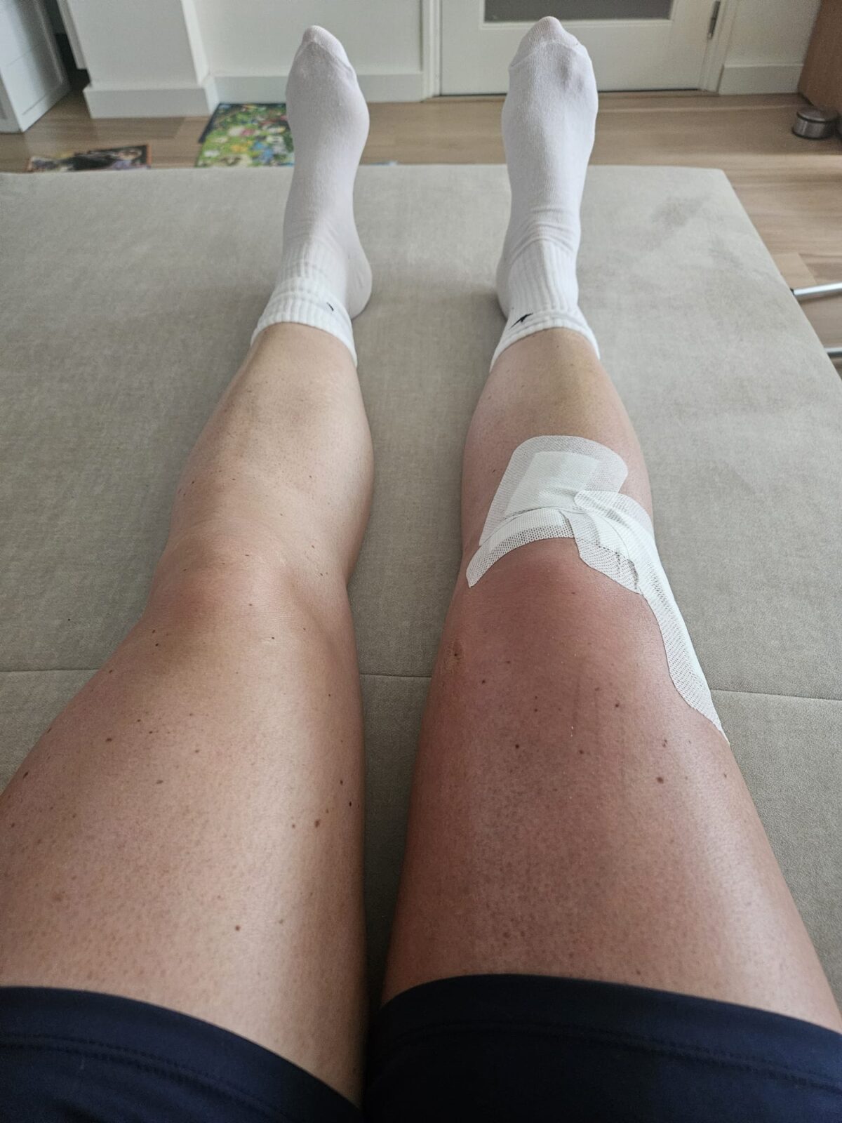 knie