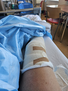 knie met verband na tweede operatie