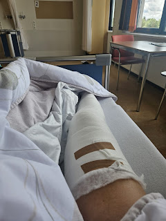 Knie in verband na voorste kruisbandoperatie
